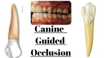 Canine Guided Occlusion. Why canine is preferred ? Mechanism and Clinical Contraindication.