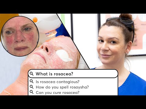 Can You Cure Rosacea? Most Google'd Questions on Rosacea | London