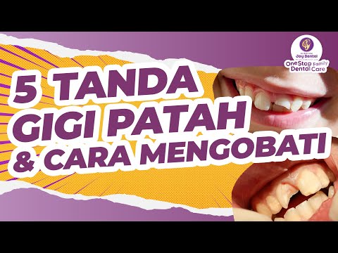 Video: Apakah gigi patah berbahaya?