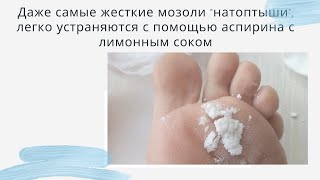 Даже самые жесткие мозоли “натоптыши”, легко устраняются с помощью аспирина с лимонным соком.