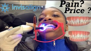 MY FIRST 24 HOURS WITH INVISALIGN : PAIN? PRICE?! VLOGMAS DAY 12