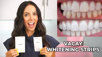 I TRIED THE VACAY TEETH WHITENING STRIPS FOR 10 DAYS *Effective* | Before & After Pictures