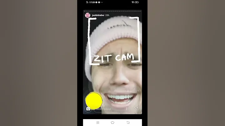 JUSTIN BIEBER STILL HAS ACNE WTF IG STORIES NOVEMBER 16 2019