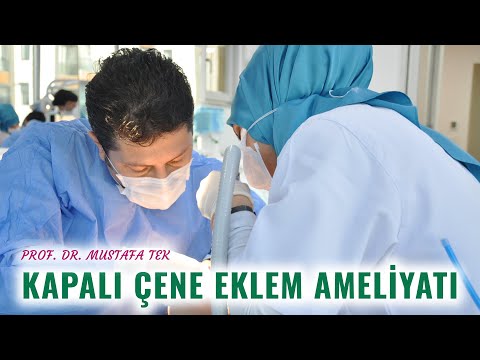 Kapalı Çene Eklem Ameliyatı | Prof. Dr. Mustafa Tek