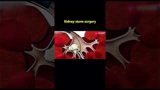 Celebrity #10 Respect the Surgical Tech #Shorts #funny #doctor Net Worth