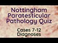 Paratesticular quiz diagnoses - Pathology mini tutorial