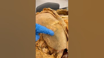 The Liver Regenerates — Why Is There Liver Cancer?