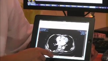 Grupo IB Carestream Vue Motion