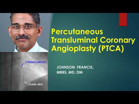 Percutaneous transluminal coronary angioplasty PTCA