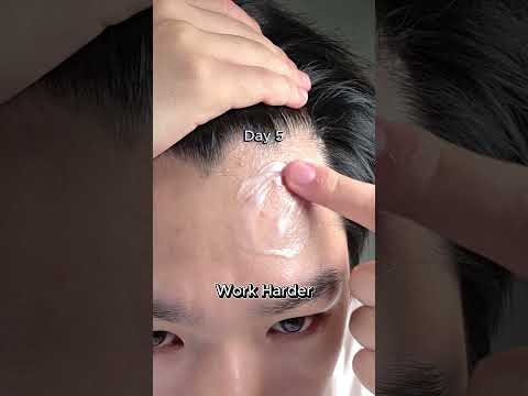 I Will SURVIVE Skincare Brightskin Skincareroutine Kbeauty Acnetreatment Acne Orien Cream