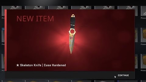 Insane Case Hardened Skeleton Knife, full lobby reaction!