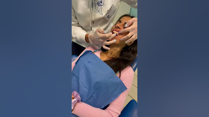 COME SI METTE E TOGLIE LA MASCHERINA TRASPARENTE PER ALLINEARE IL TUO SORRISO?