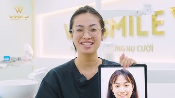Trọn vẹn cảm xúc ngày tháo mắc cài sau 2 năm niềng răng| Nha khoa Win Smile