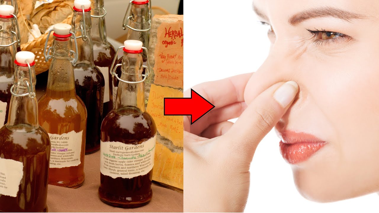 5 Natural Remedies To Control Bad Vaginal Odor YouTube