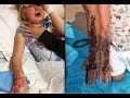 ¡Cuidado! Mira lo que le pasó a esta niña por un tatuaje temporal