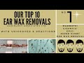 TOP 10 EAR WAX REMOVAL VIDEOS - NUMBER 1