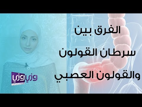 الفرق بين أعراض سرطان القولون والقولون العصبي