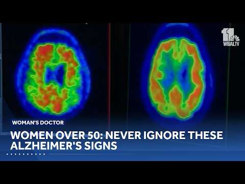Women over 50: Never ignore these Alzheimer's signs