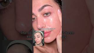 Skincare Routine For Clear Skin