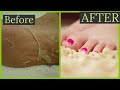 I TRIED CRAZY PEEL OFF FOOT MASK.HOW TO USE PEEL OFF FOOT MASK  .easylife