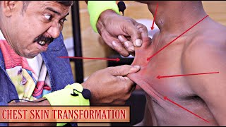 Chest Transformation with Cracking | ASMR by Asim Barber | Hair, Neck, Body dangerous cracks