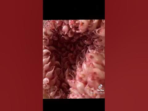 How a vigina/pussy looks like under a microscope - YouTube