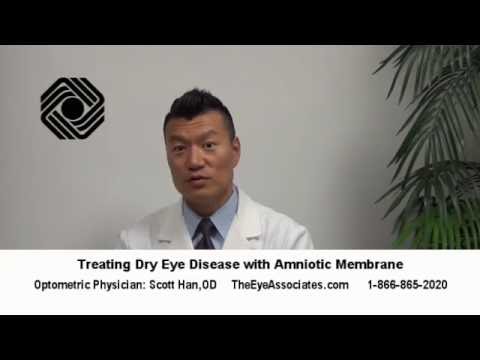Could Amniotic Membrane Help Your Dry Eyes? - YouTube