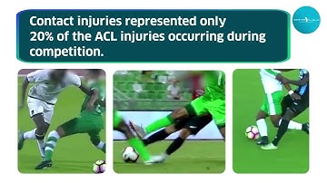 Mechanisms of ACL injuries in men’s football: A systematic video analysis.