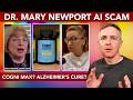 Dr Mary Newport S Alzheimer S Cure Cogni Max Dementia Capsules Scam Exposed 
