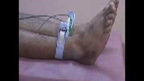 Recording of a basic ECG video