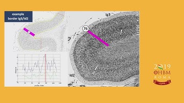 OHBM 2019 | Oral Sessions | : Mapping the Cytoarchitectonic Basis of Socio - Emotional and Cog…