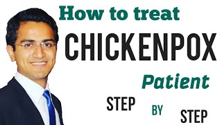 Chicken Pox Treatment, Symptoms, Diagnosis, Management, Infectious Medicine Lecture USMLE/NCLEX