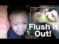 Scared Little Boy's Earwax Finally Removed by Ear Irrigation- The Best Option