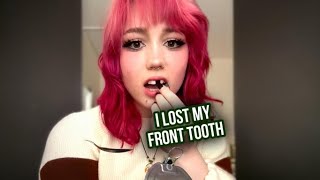 I Lost My Tooth Over A Sausage Roll 🦷 | STORYTRENDER