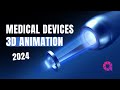 Medical devices 3d animation  arcreative 2024