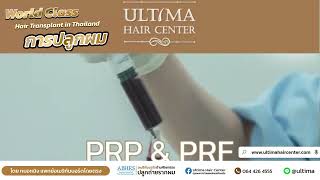 ปลูกผมผู้ชาย เตรียมนัดปลูกผม คุณชาโย รีวิว #ปลูกผม #abhrs | Ultima Hair Center Line:@ultima