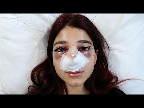 فيديو: دارينا إروين قبل وبعد الجراحة التجميلية