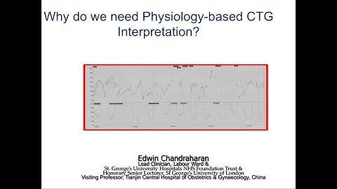 Why do we need Physiology-based CTG Interpretation