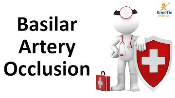 Patient History: BASILAR ARTERY OCCLUSION