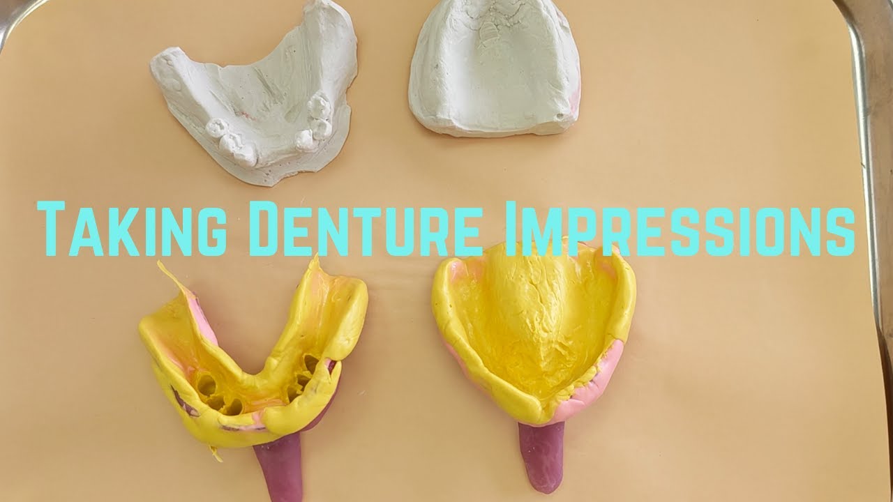 Taking Denture Impressions YouTube