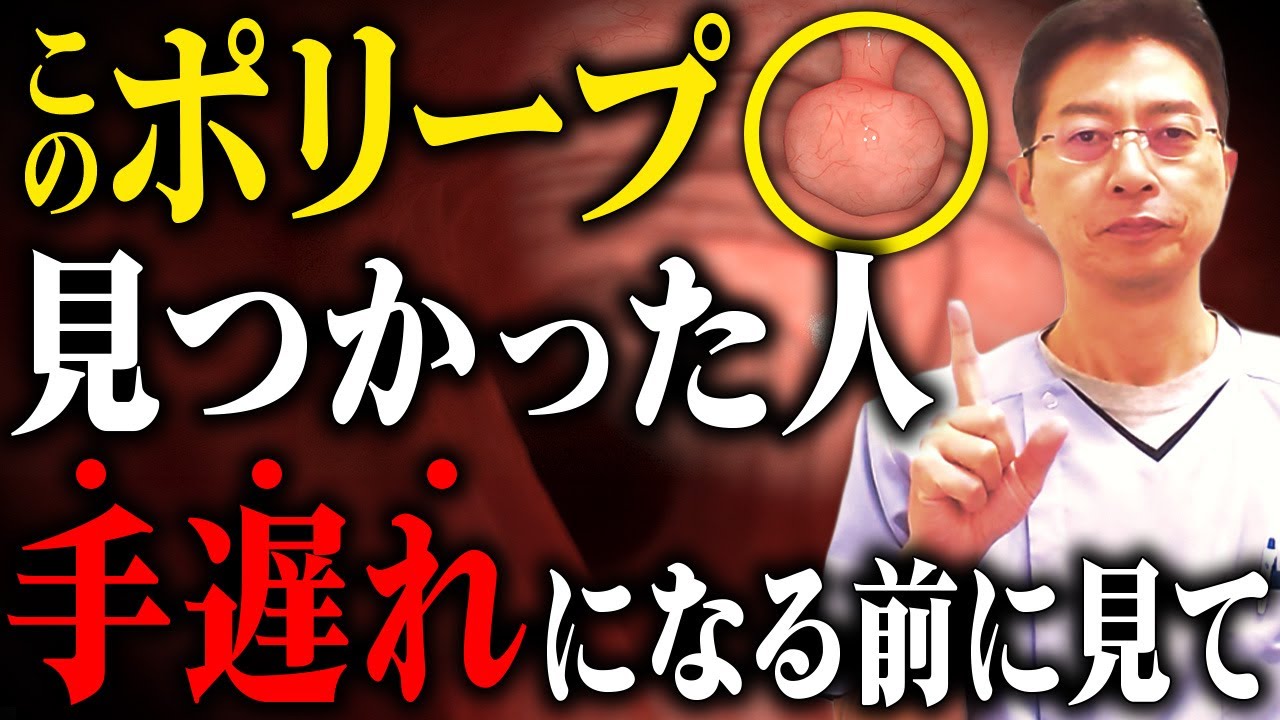【ポリープが大腸がんに…】大腸ポリープが見つかったら必ず見てください【へき地医療現役医師/100年生きる予防医学】