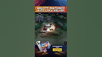 Matdinzz: Eyes on Sl4sh 😎