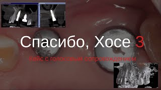 Спасибо, Хосе 3. IDR.