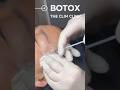 Clim Clinic, Botox