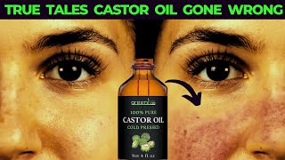 Mastering Castor Oil: Key Mistakes You Need to Stop Making ASAP