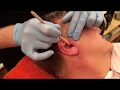 Mens nose and ear waxing tutorial