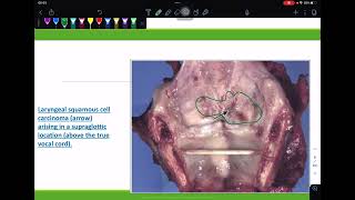 RS pathology lab part 1 - 2023