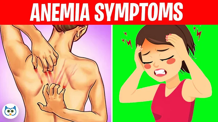 8 Silent Symptoms of Anemia You Shouldn’t Ignore - DayDayNews