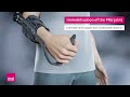 Medi epico roms  elbow brace for mobilization with immobilization of the pru joint