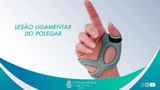Meu do ardente dor articulações polegar nas